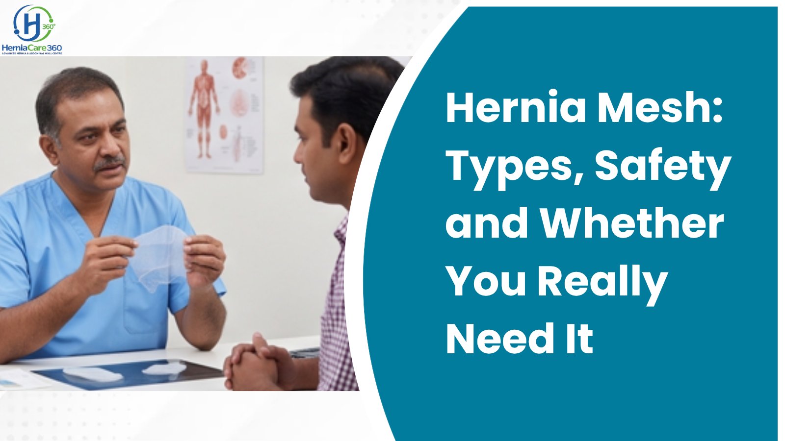 Hernia Mesh: Types, Safety and Whether You Really Need It