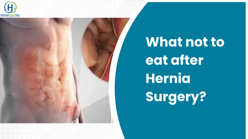 What not to eat after Hernia Surgery?