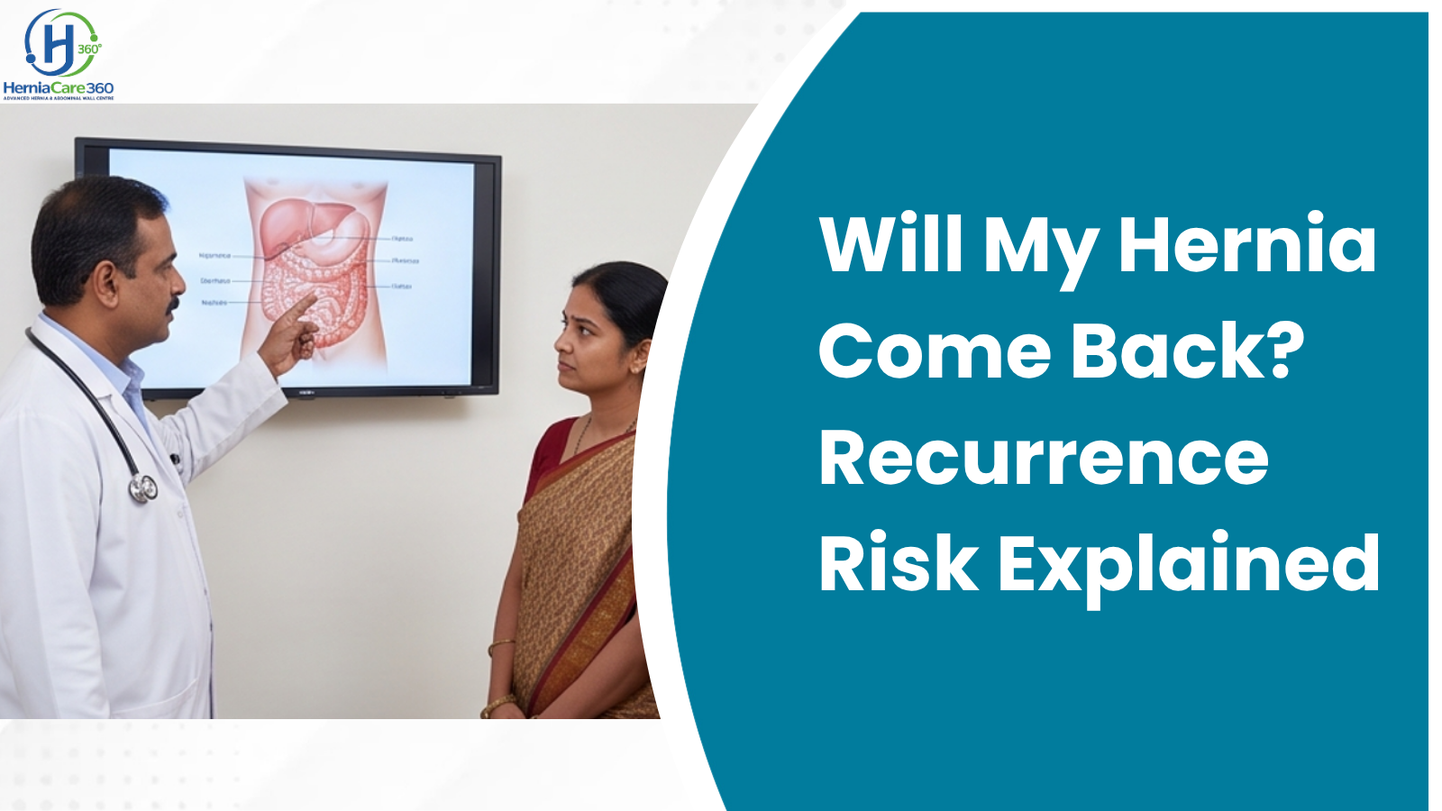 Will My Hernia Come Back? Recurrence Risk Explained