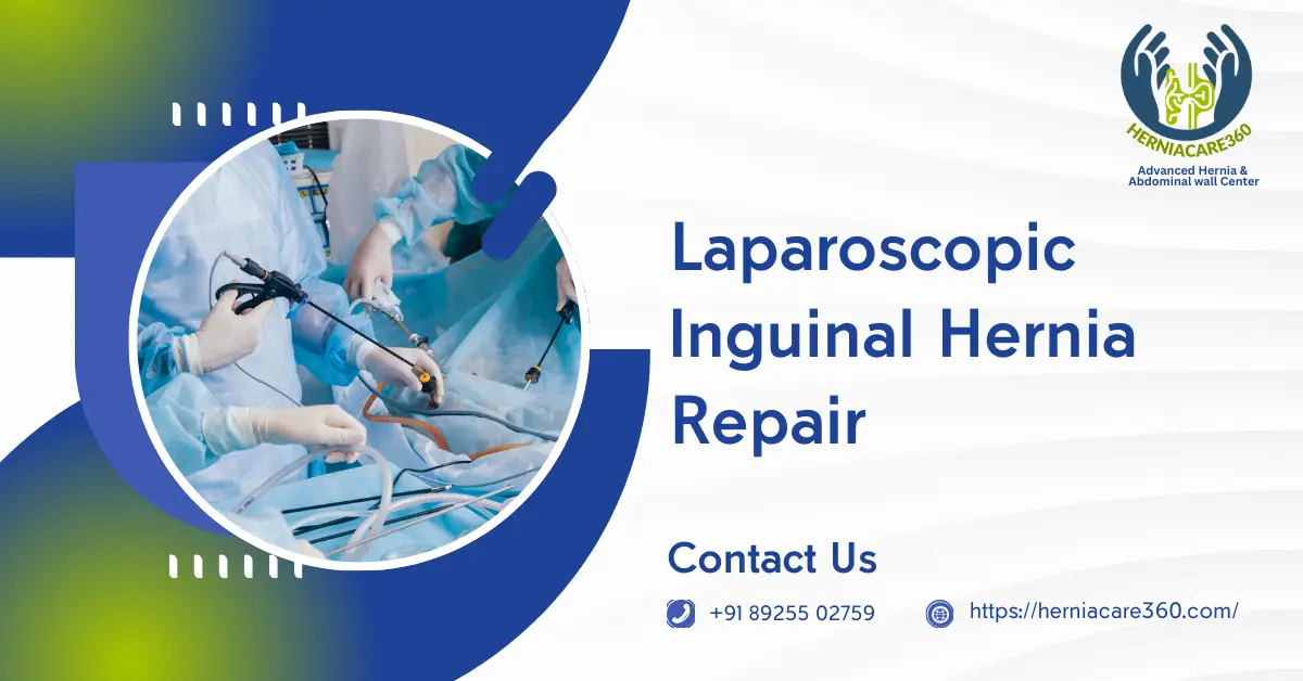 Laparoscopic Inguinal Hernia Repair